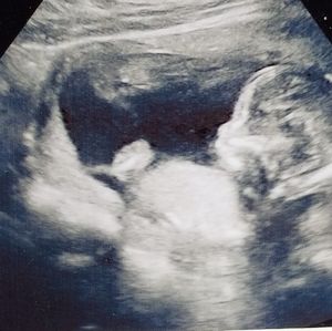 Meet your Posher, Lea-anne